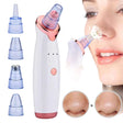 Extractor de imperfecciones faciales blanco y azul, con succión ajustable y cabezales intercambiables para limpieza profunda de poros.-1-1-1